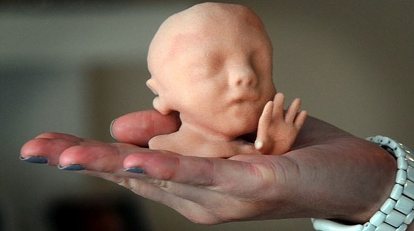 Hold your baby before it's born: 3-D foetus models